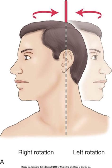 Image result for Contralateral Head Rotation