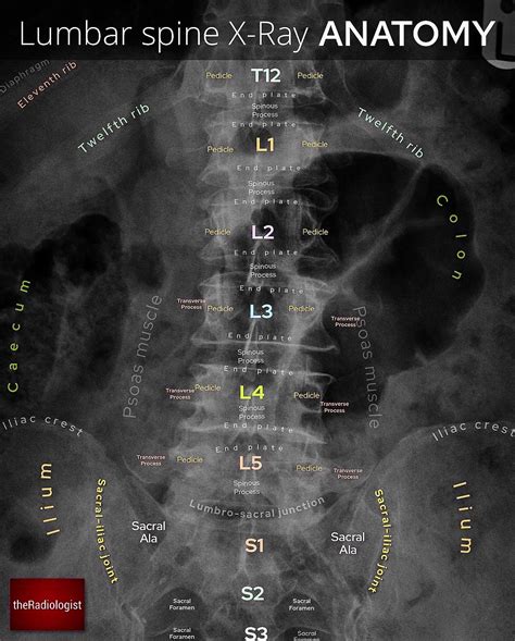 Lumbar Spine Anatomy Xray