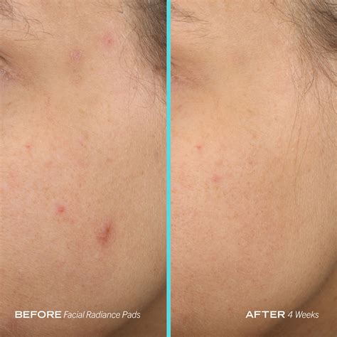 Facial Radiance Pads • 60 pads