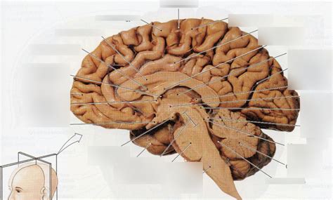 Normal Human Brain 的图像结果