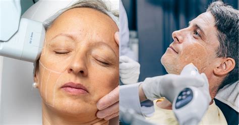 Hifu Vs Thermage: Which is Best Anti Ageing Treatment For You?