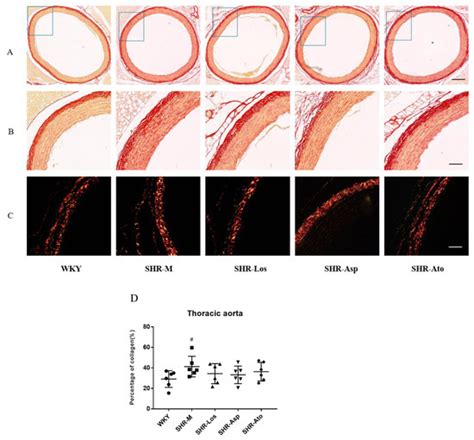 Effects of Long-Term Intervention with Losartan, Aspirin and ...
