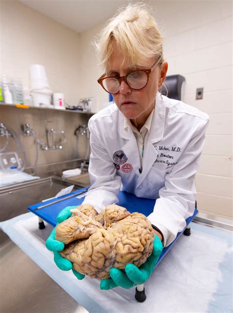 CTE Brain 的图像结果