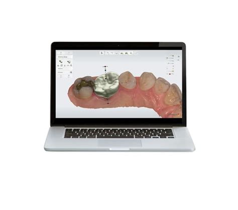 3Shape Design Studio 的图像结果