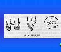 Image result for 洞 cavity