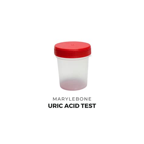 Uric Acid (Urine) Test - Marylebone Diagnostic Centre