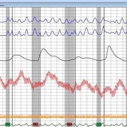 Image result for Polygraph Practice