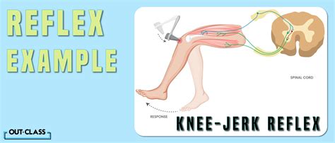 Image result for Contralateral Reflex Example