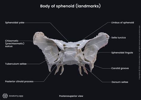 Sphenoid Bone Sella Turcica