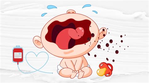 Understanding Why Your Baby Is Spitting Up Blood: Essential Guidance - SleepBaby.org