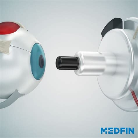 MedfinUntreated Cataract Leads to Loss of Vision? Read More! - Medfin