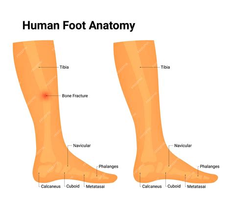 인간 발 해부학 터 일러스트레이션 티비아 골절 Navicular Phalanges Calcaneus | 프리미엄 벡터
