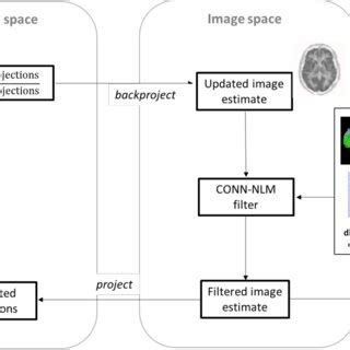 Image result for Iterative Reconstruction Osem