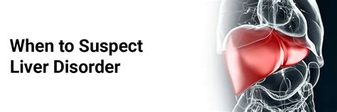 When to Suspect Liver Disorder