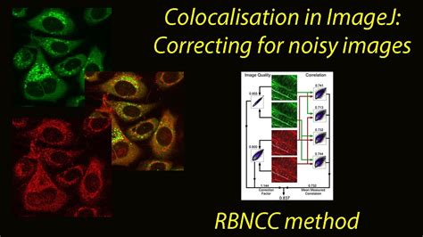 Image result for ImageJ Colocalization Coloc