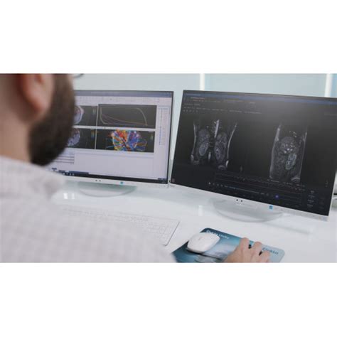 Image result for Unity Accelerator