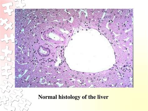 Image result for Normal Liver Function