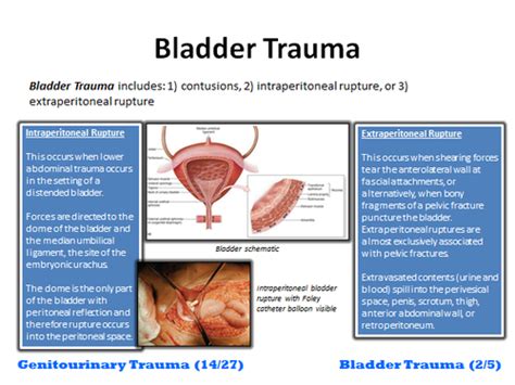 Image result for Bladder Explode