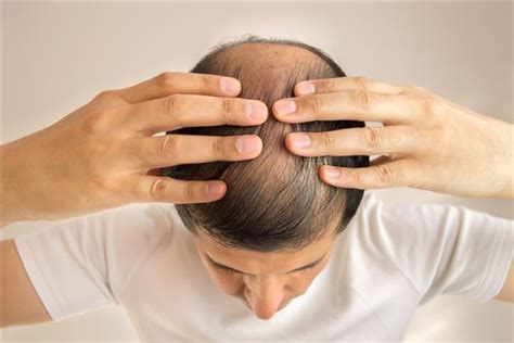 每天大把大把的掉发，最大的原因可能就是用到假洗发水了。 - 知乎