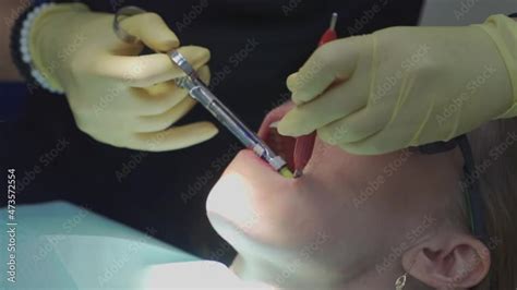 Image result for Tooth Extraction Injection