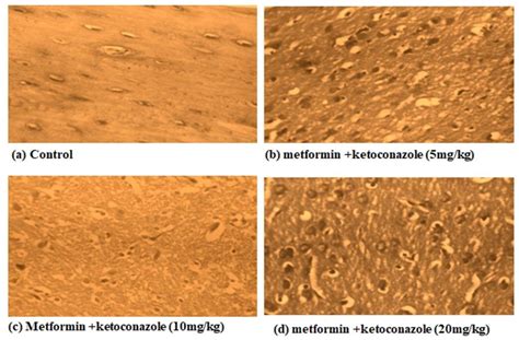 Evaluation of antifertility potential of ketoconazole and assessment of ...