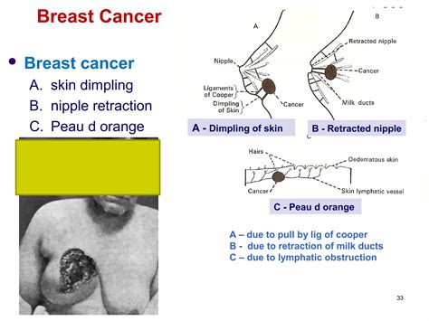 6. mammary gland | PPT
