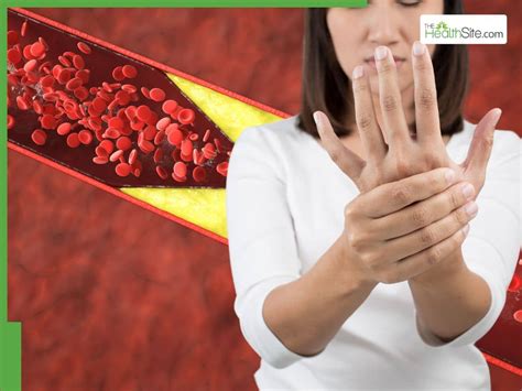 Signs of High Cholesterol In Fingers At Night: 5 Warning Symptoms of ...