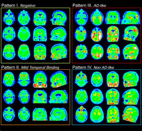 Image result for Examples of Distribution Patterns