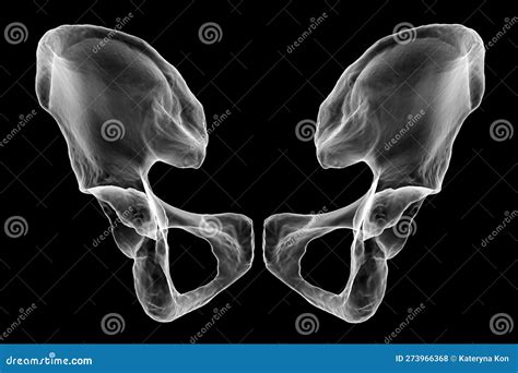 Anatomy of the Coxal Bones, Showcasing Their Intricate Details and ...