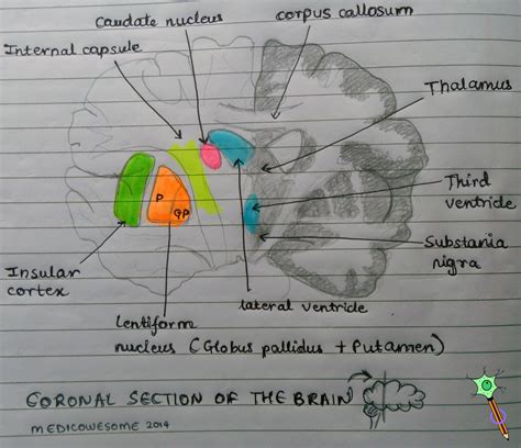 Medicowesome: Coronal section of the brain highlighting lentiform ...