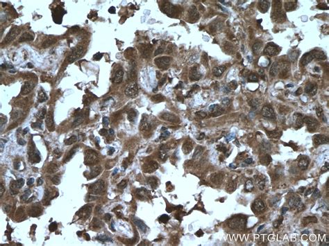 AKAP13 antibody (27947-1-AP) | Proteintech