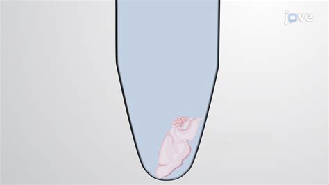 Image result for Brain Tissue Sample