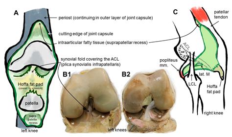 Posterior Cruciate Ligament Origin And Insertion