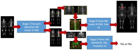 Bone Metastasis Detection in the Chest and Pelvis from a Whole-Body ...