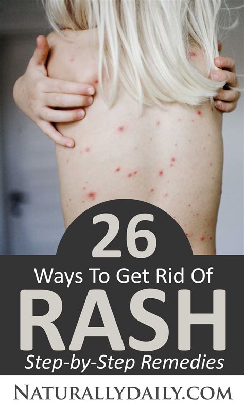 How To Get Rid Of Rash On Skin Fast? - PBFBDP