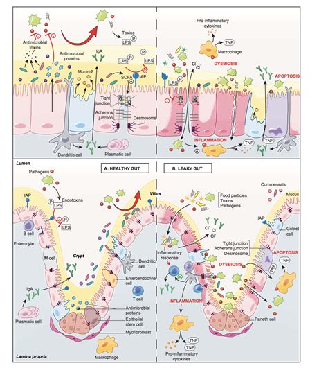 Probiotics for SIBO: Helpful or Harmful? (Evidence & Strains)