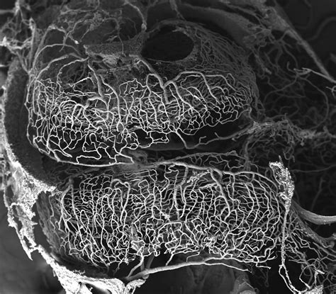Electron Microscopy Cell 的图像结果