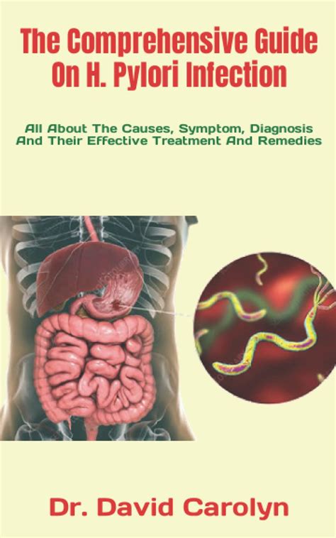 Buy The Comprehensive Guide On H. Pylori Infection: All About The ...