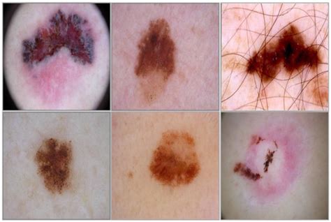 Applied Sciences | Special Issue : Deep Learning and Machine Learning ...