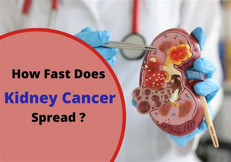 How Does Cancer Spread