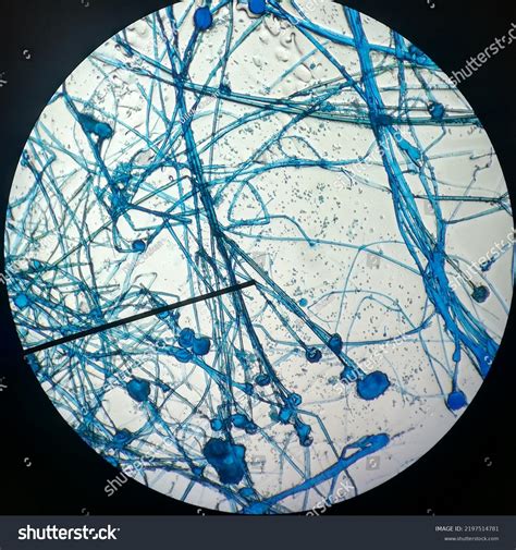 Rhizopus Stolonifer Microscope
