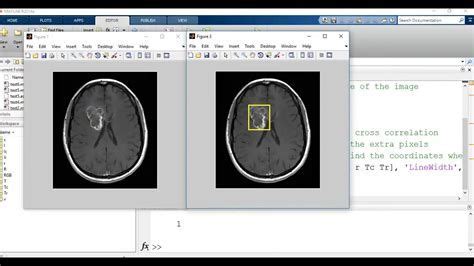 Template Matching MATLAB 的图像结果