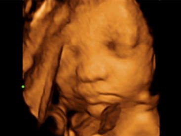 DC-40 - Primary Care Ultrasound Systems - Mindray India