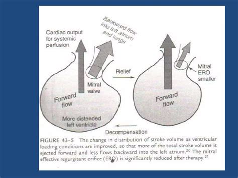 Acute decompensated heart failure | PPTX