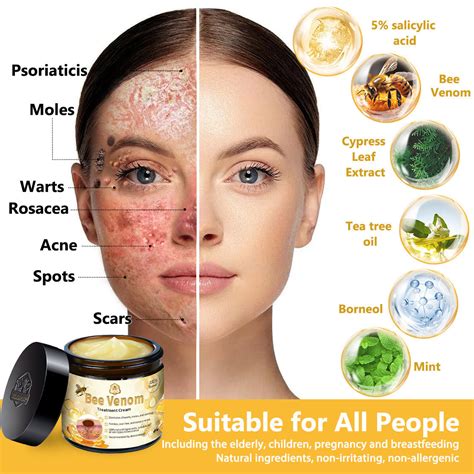 𝗧𝗟𝗢𝗣𝗔® Bee Venom Skin Treatment Cream - Tlopa