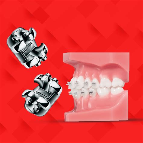 Orthodontics – Healix