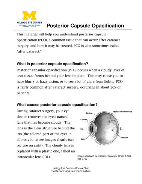 Posterior Capusle Opacification - Posterior Capsule O pacification This ...