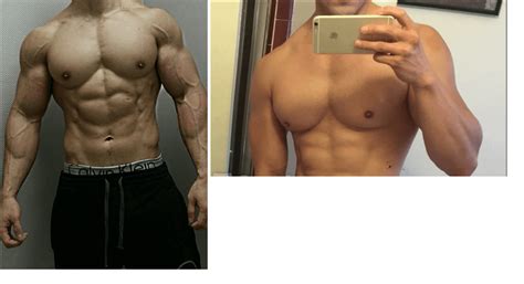 Can someone show me what different muscle insertions look like? : r ...