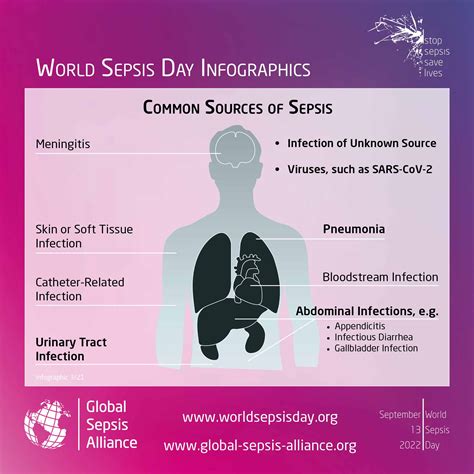 How Common Is Sepsis