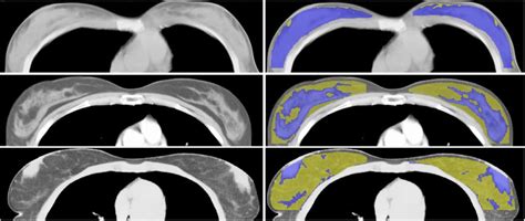 Sample Algorithm 的图像结果
